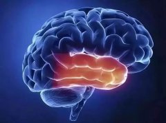脑卒中防治知识 脑卒中如何预防