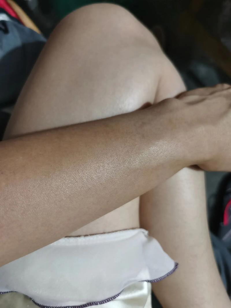 自闭小孩被揍 自闭症暴力打人