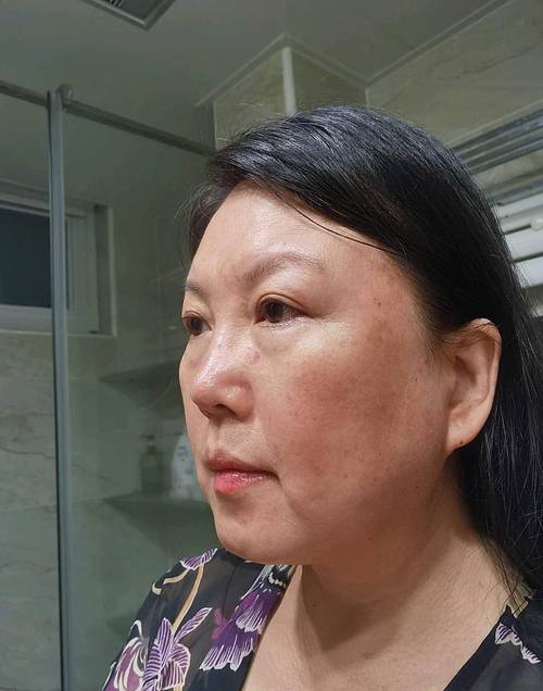 自闭干预成功案例 自闭干预方法