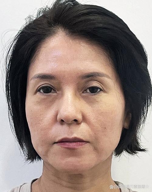 自闭后发泄的方式有哪些