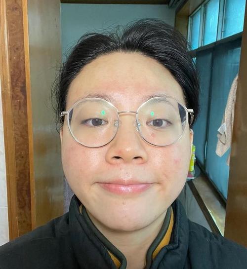 自闭症儿童能够逗笑吗