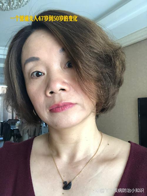 精子畸形自闭症(自闭症精细)