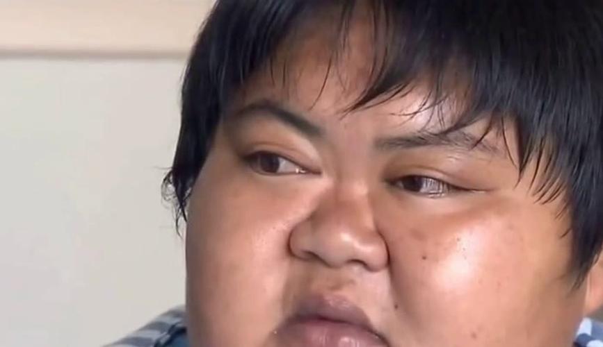 自闭症儿童的关注现状