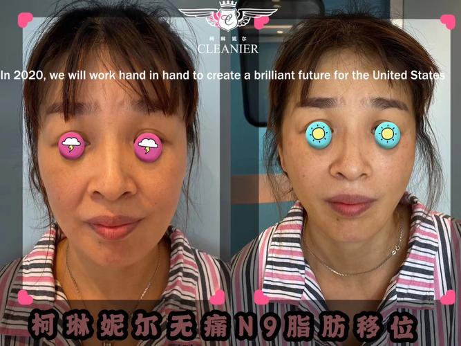 蜂蜜加陈醋治疗自闭症吗