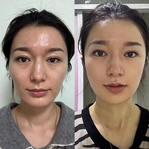 表示自闭的音乐表示自闭的音乐词语