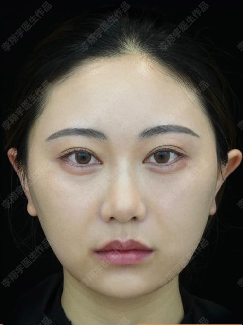 青少年自闭症如何调理好