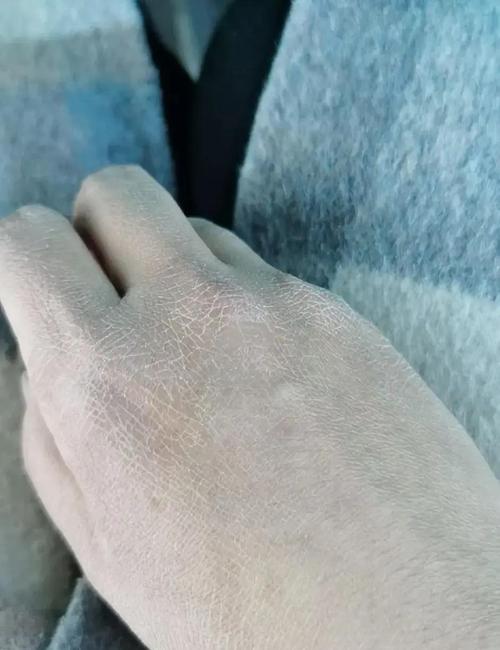 自闭症宝宝饮食两岁以下