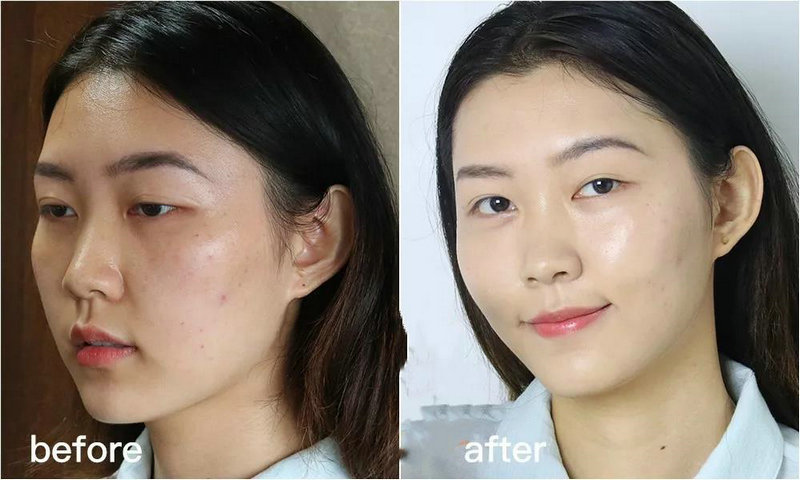 自闭症患者长大后 自闭症患者长大后怎么生活