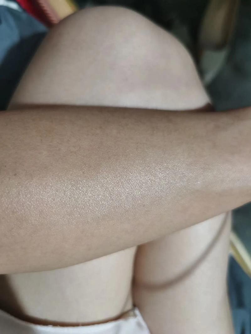 社恐自闭摆烂 社恐自闭怎么办