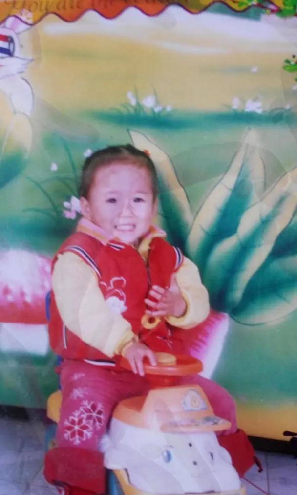 长期自闭会引起斗鸡眼吗