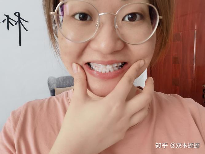 儿童自闭症三种类型表现