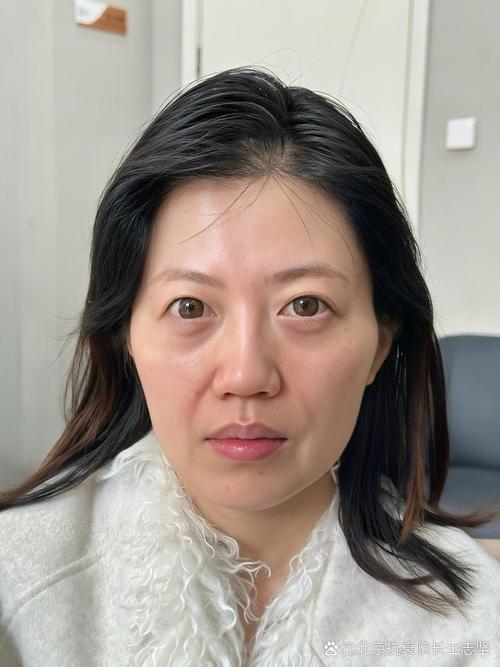 自闭那家好(哪家自闭症机构好)