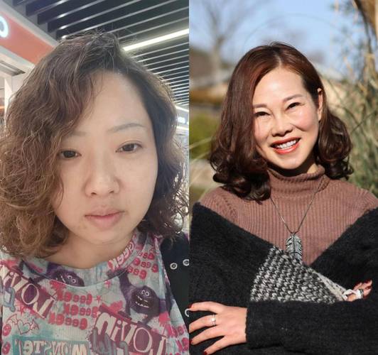 麦谷蛋白对自闭症的影响