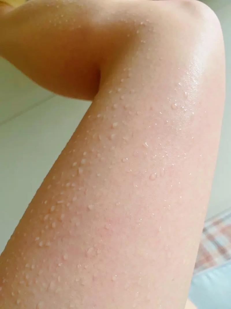 自闭症治疗不及时怎么办