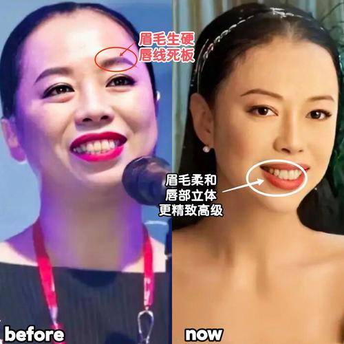 后天自闭症长大会怎么样