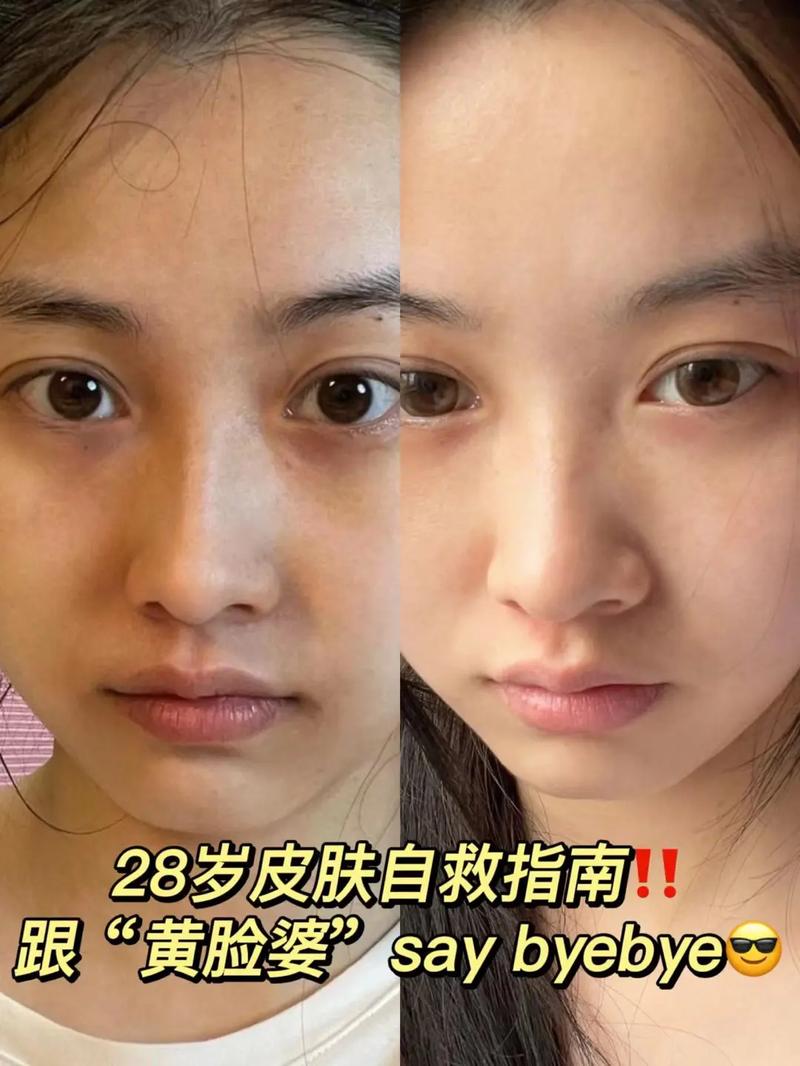 自闭症孩子容易积食吗