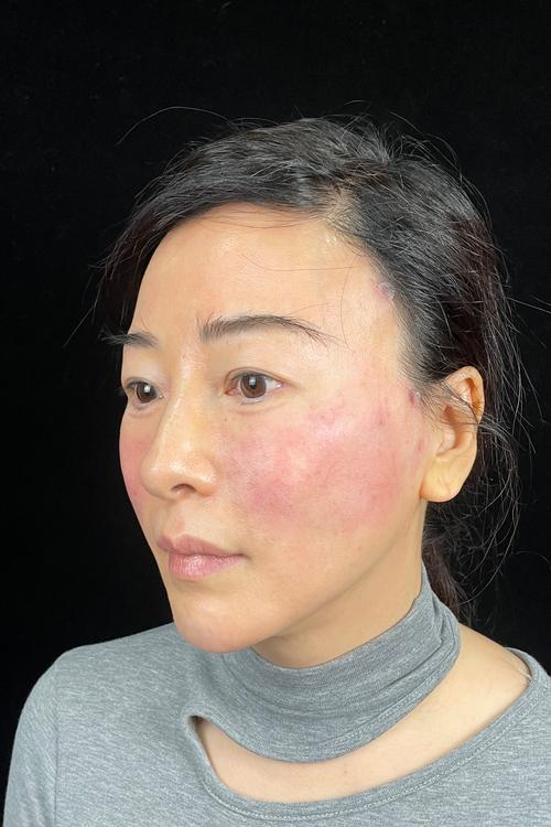 自闭症孩子语言发音障碍