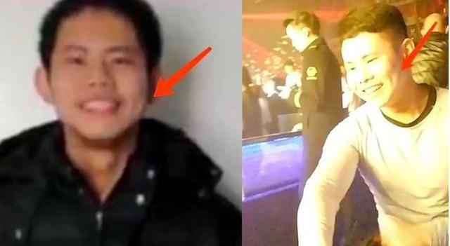 小孩28岁自闭_小孩儿自闭