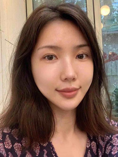 脑电治疗自闭 自闭症脑电波治疗