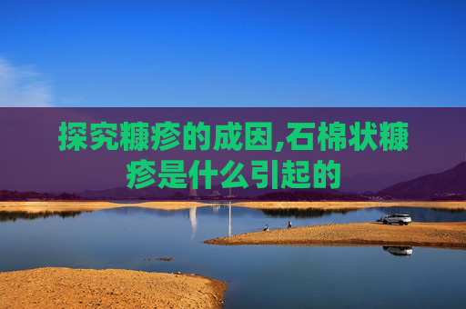 探究糠疹的成因,石棉状糠疹是什么引起的