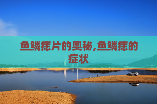 鱼鳞痣片的奥秘,鱼鳞痣的症状