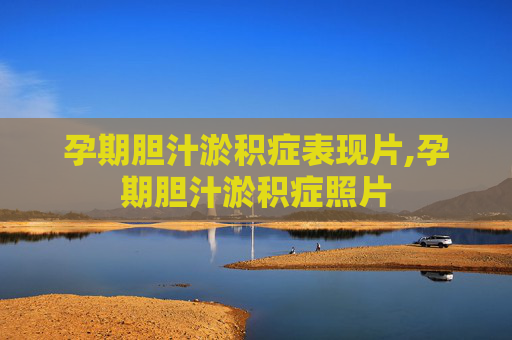 孕期胆汁淤积症表现片,孕期胆汁淤积症照片