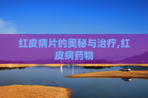 红皮病片的奥秘与治疗,红皮病药物