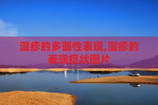 湿疹的多面性表现,湿疹的表现症状图片
