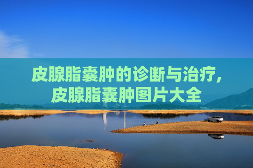 皮腺脂囊肿的诊断与治疗,皮腺脂囊肿图片大全