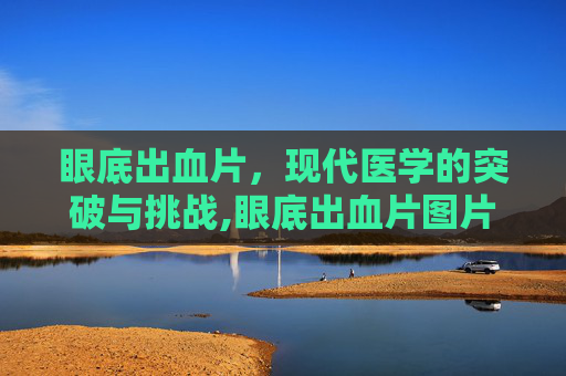 眼底出血片，现代医学的突破与挑战,眼底出血片图片大全