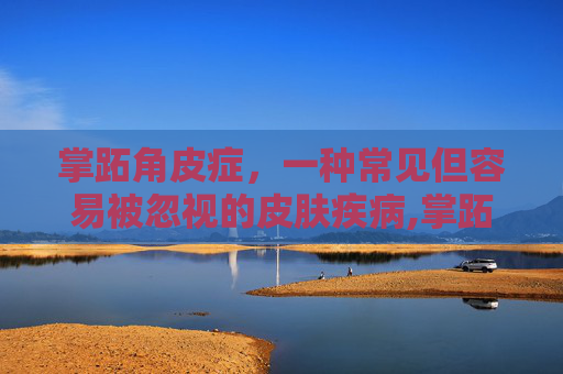 掌跖角皮症，一种常见但容易被忽视的皮肤疾病,掌跖角皮症治疗方法