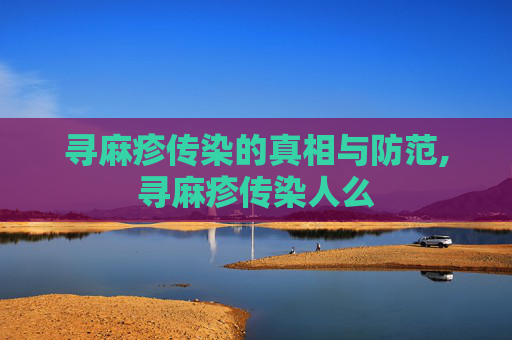 寻麻疹传染的真相与防范,寻麻疹传染人么