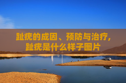 趾疣的成因、预防与治疗,趾疣是什么样子图片