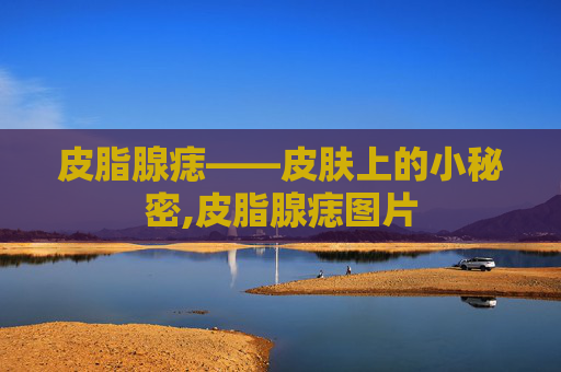 皮脂腺痣——皮肤上的小秘密,皮脂腺痣图片