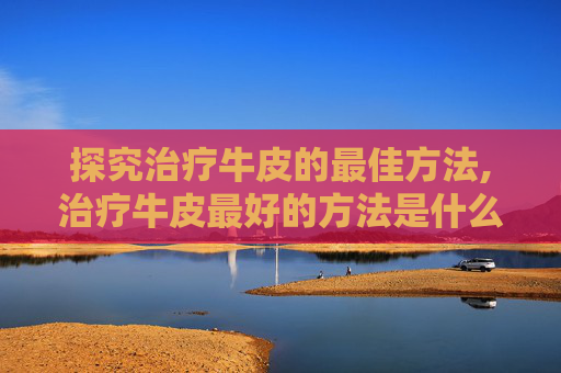 探究治疗牛皮的最佳方法,治疗牛皮最好的方法是什么