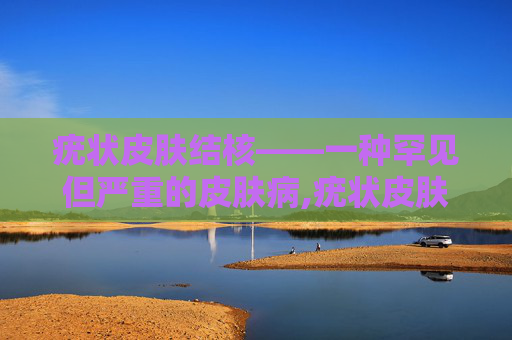 疣状皮肤结核——一种罕见但严重的皮肤病,疣状皮肤结核三廓征