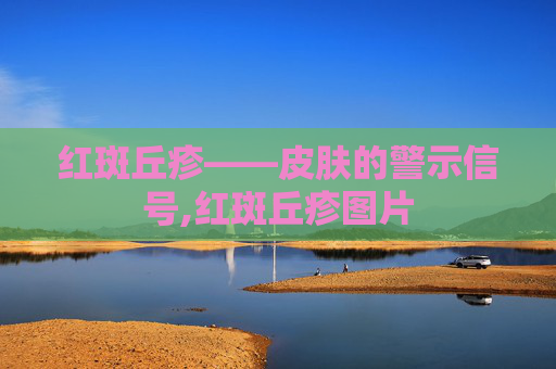 红斑丘疹——皮肤的警示信号,红斑丘疹图片
