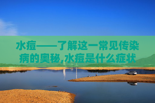 水痘——了解这一常见传染病的奥秘,水痘是什么症状 水痘——了解这一常见传染病的奥秘,水痘是什么症状