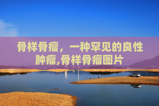骨样骨瘤，一种罕见的良性肿瘤,骨样骨瘤图片