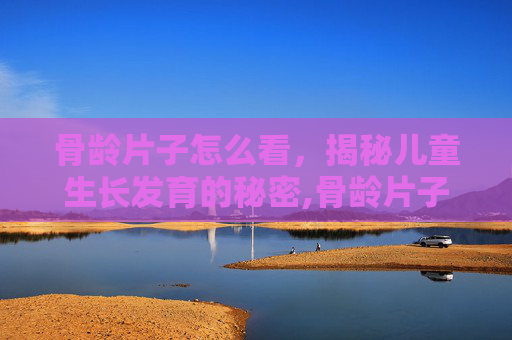 骨龄片子怎么看,揭秘儿童生长发育的秘密,骨龄片子怎么看图解 骨龄片子怎么看,揭秘儿童生长发育的秘密,骨龄片子怎么看图解
