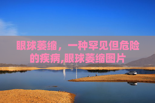 眼球萎缩，一种罕见但危险的疾病,眼球萎缩图片