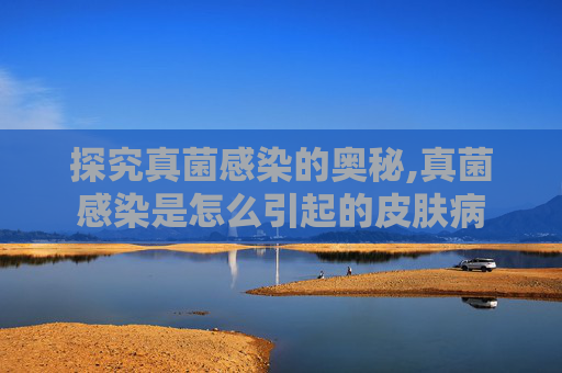 探究真菌感染的奥秘,真菌感染是怎么引起的皮肤病