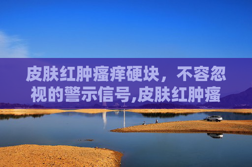 皮肤红肿瘙痒硬块，不容忽视的警示信号,皮肤红肿瘙痒硬块用什么药