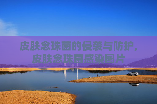 皮肤念珠菌的侵袭与防护,皮肤念珠菌感染图片
