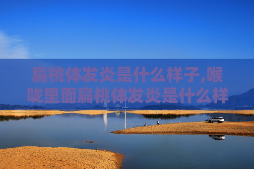 扁桃体发炎是什么样子,喉咙里面扁桃体发炎是什么样子