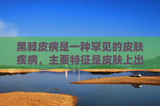 黑棘皮病是一种罕见的皮肤疾病，主要特征是皮肤上出现黑色或深棕色的斑块。这种病症通常与内分泌紊乱有关，因此治疗需要综合考虑患者的内分泌状况。以下是关于黑棘皮病的治疗建议，,肥胖引起的黑棘皮病怎么治疗